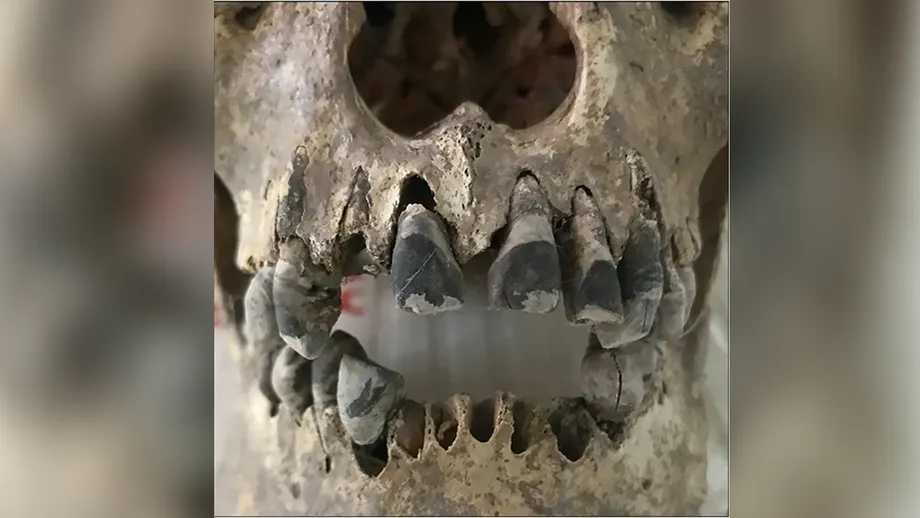 Les dents noircies des anciens Vietnamiens : comment les communautés de l’âge du fer ont créé un idéal de beauté qui a duré 2 000 ans